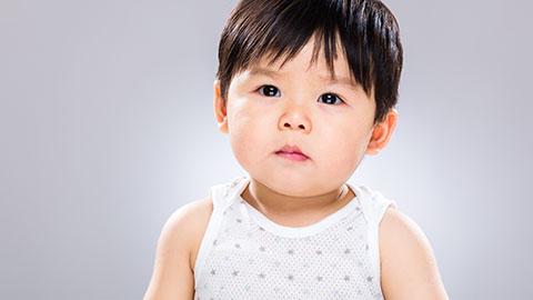 Langkah Menangani Bayi yang Alergi Susu Sapi