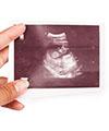 Keluhan _ Tips pada Trimester Pertama Kehamilan